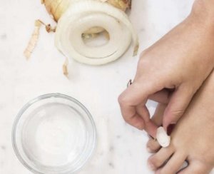 Печена цибуля: користь і шкода для здоров'я, лікування діабету відгуки