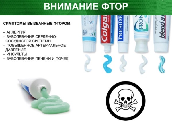 Фтор в зубній пасті: користь і шкода, як правильно чистити зуби