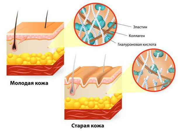 Ботокс або гіалуронка: що краще, що дорожче, плюси і мінуси кожного способу