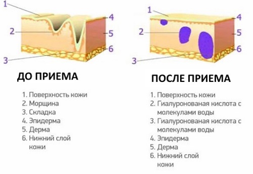 Гіалуронова кислота: користь і шкода, відгуки, фото до і після, застосування