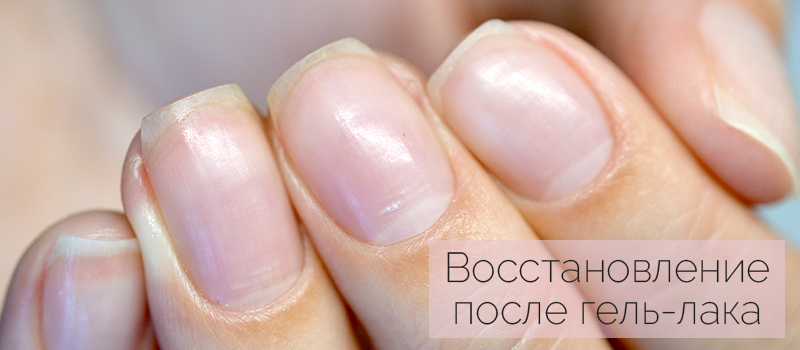 Восстановление ногтей