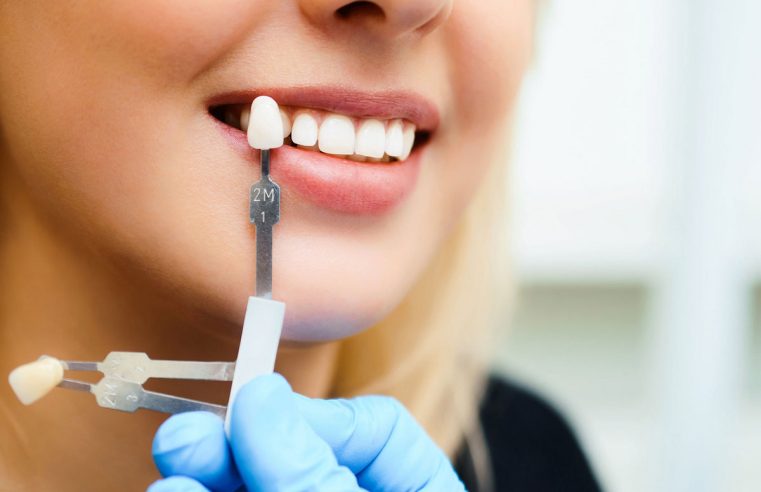 Скільки коштує наростити зуб